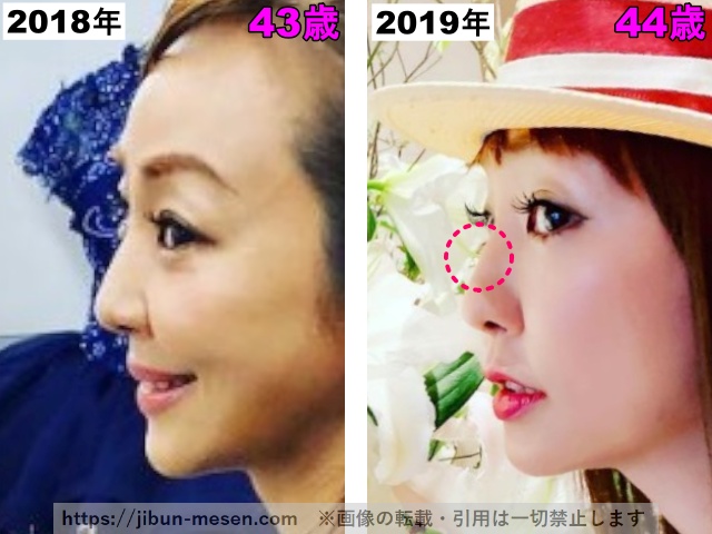 神田うのの鼻の高さの比較の画像