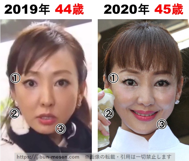 神田うのの整形検証2019年〜2020年の画像