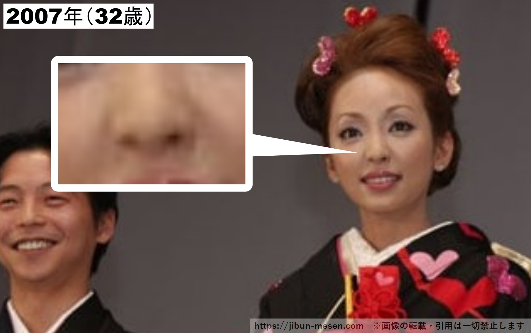 ほうれい線がある神田うのの画像