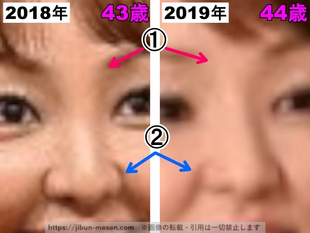 神田うのの鼻の整形検証2018〜2019年（拡大）の画像