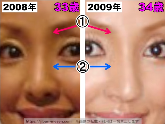 神田うのの鼻の整形検証2008〜2009年（拡大）の画像