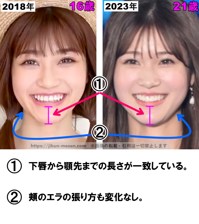 1 下唇から顎先までの長さが一致している。2 頬のエラの張り方も変化なし。