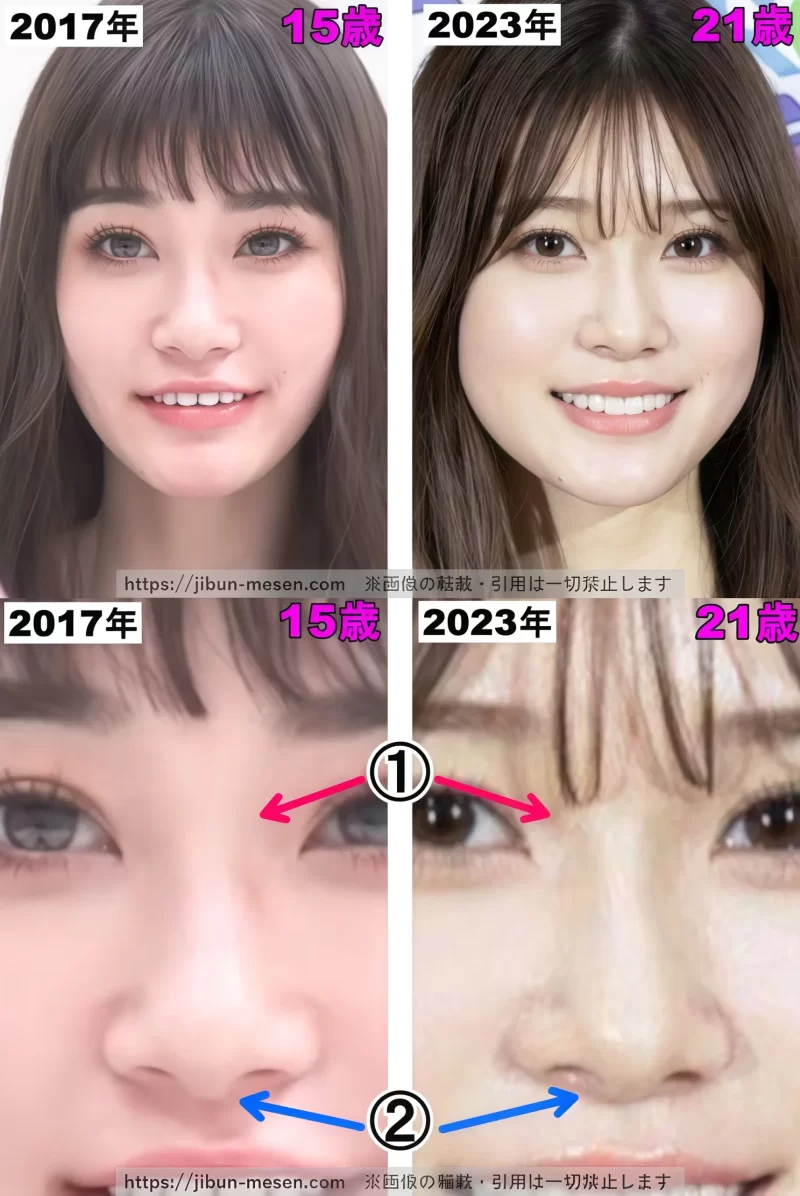 生見愛瑠（めるる）の鼻の整形検証2017年〜２０２３年の画像