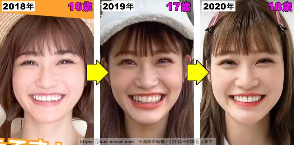 生見愛瑠の歯並びの変化の画像