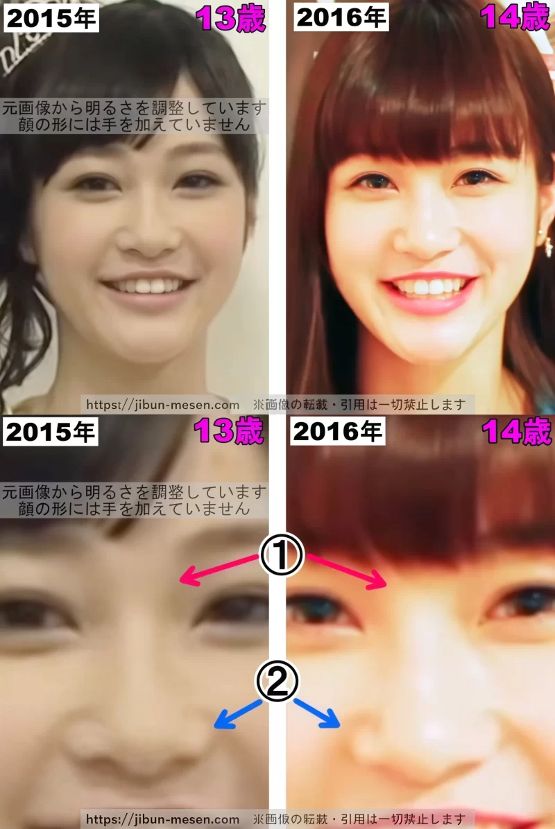生見愛瑠（めるる）の鼻の整形検証2015年〜2016年の画像