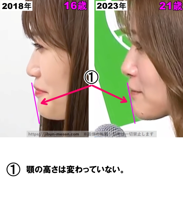 顎の高さは変わっていない。