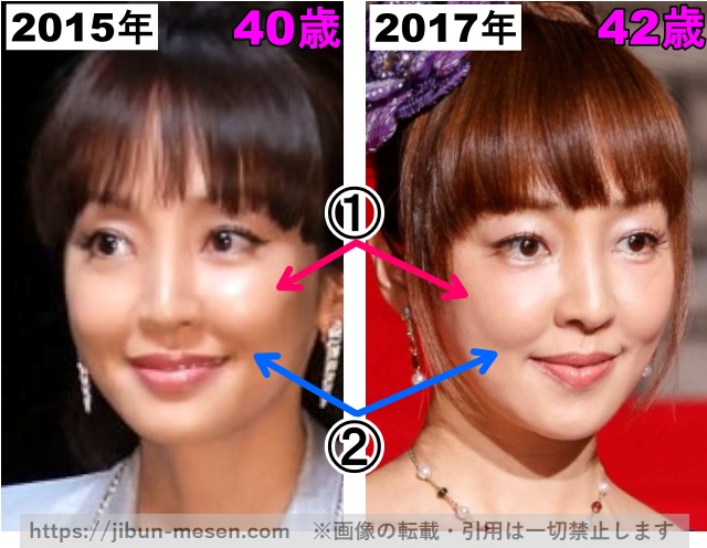 神田うのの頬の劣化2015年〜2017年（拡大）の画像