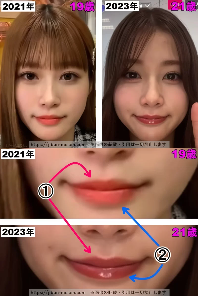 生見愛瑠(めるる)の口の整形検証2021〜2023年の画像