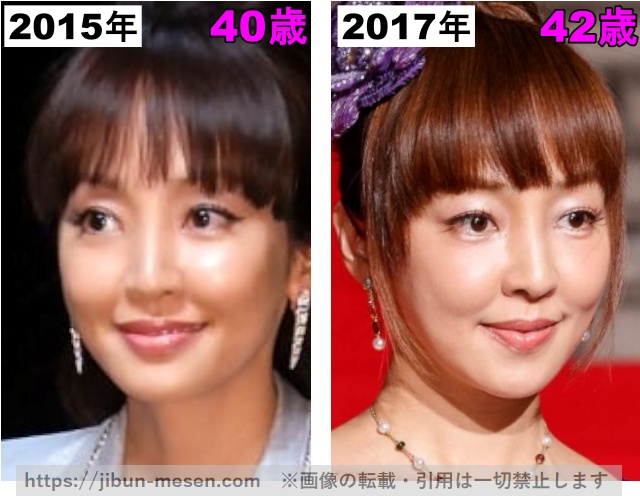神田うのの頬の劣化2015年〜2017年の画像