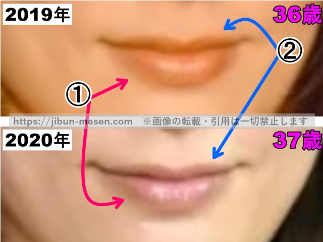 水川あさみの唇の整形検証2019年〜2020年（拡大）の画像