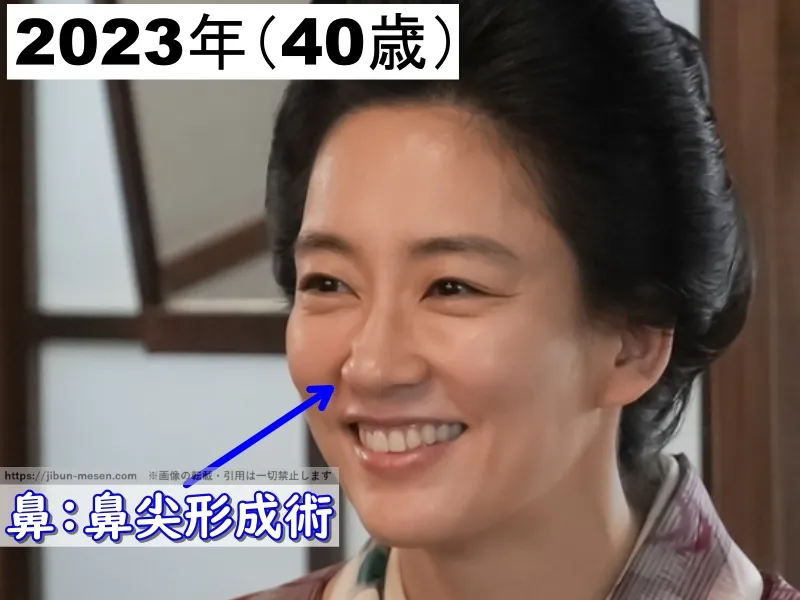 水川あさみが整形した箇所