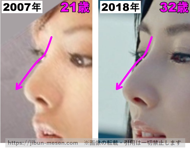 北川景子の鼻の整形検証2007年〜2018年（拡大）の画像