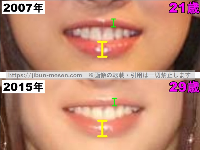 北川景子の唇の整形検証2007年〜2015年（拡大）の画像