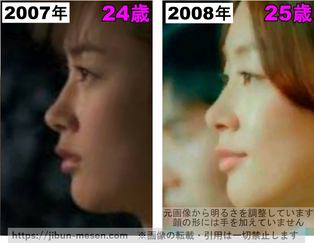 水川あさみの鼻の整形検証2007年〜2008年その1の画像