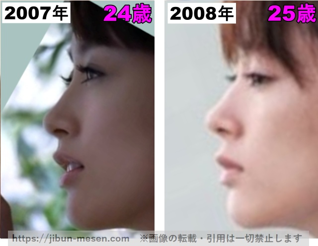 水川あさみの鼻の整形検証2007年〜2008年その2の画像