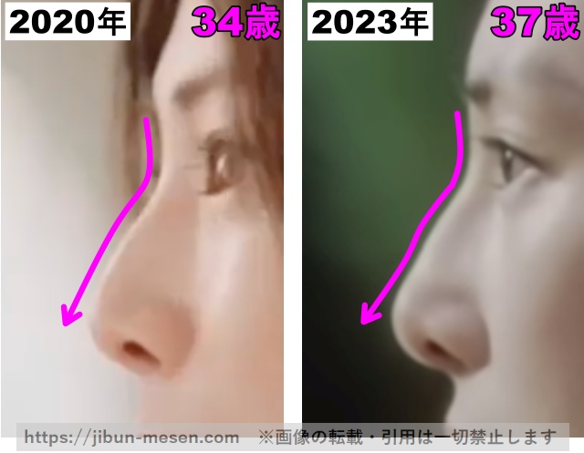 北川景子の鼻の整形検証2020年〜2023年（拡大）の画像