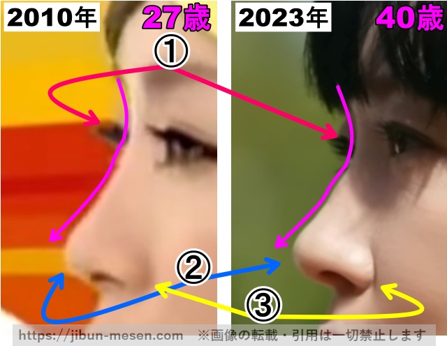 水川あさみの鼻の整形検証2010〜2023年（拡大）の画像