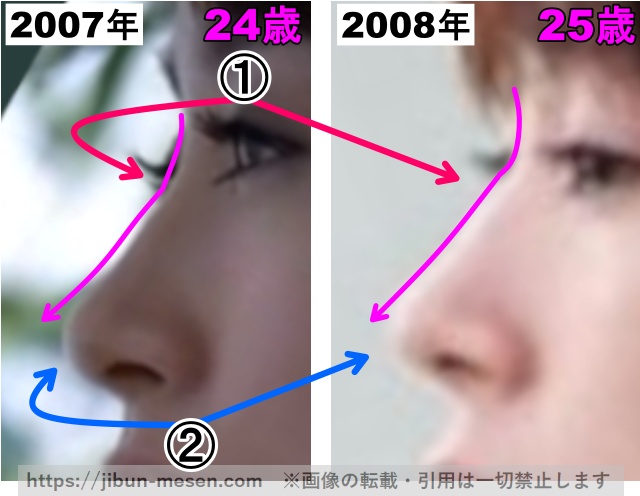 水川あさみの鼻の整形検証2007年〜2008年その2（拡大）の画像