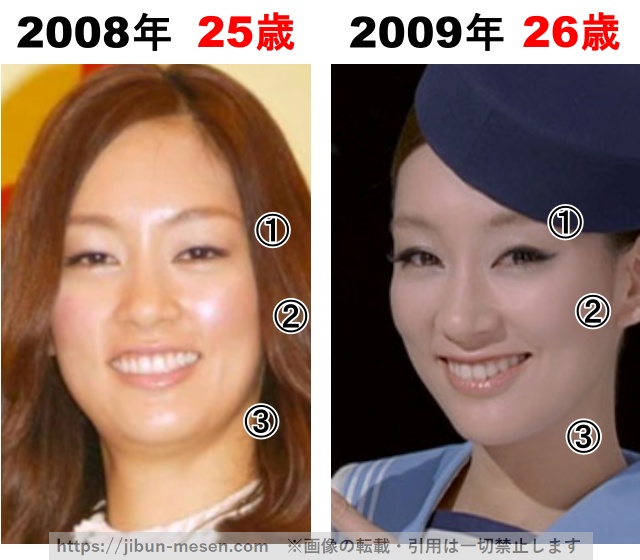 水川あさみの整形検証2008年〜2009年の画像