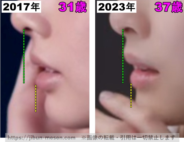 北川景子の唇の整形検証2017年〜2023年（拡大）の画像