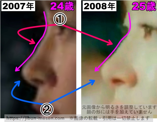 水川あさみの鼻の整形検証2007年〜2008年その1（拡大）の画像