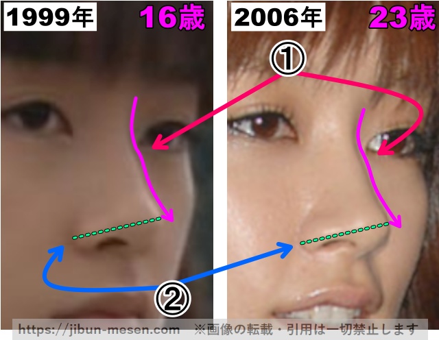 水川あさみの鼻の整形検証1999年〜2006年（拡大）の画像
