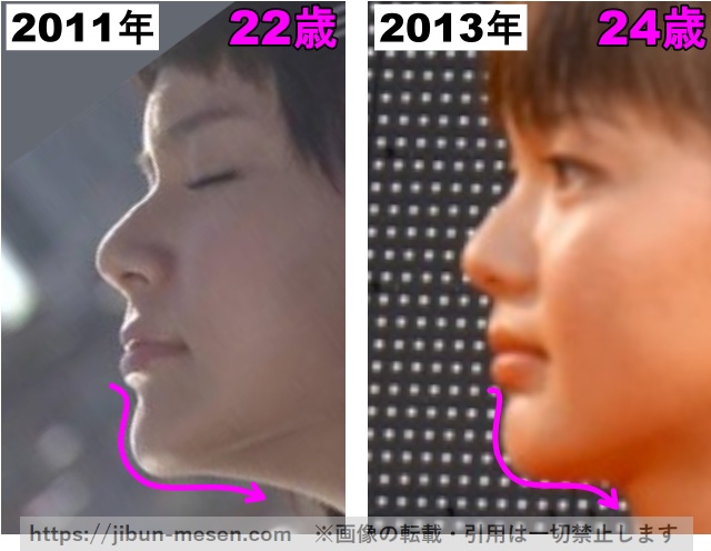 多部未華子の顎の整形検証2011年〜2013年（拡大）の画像