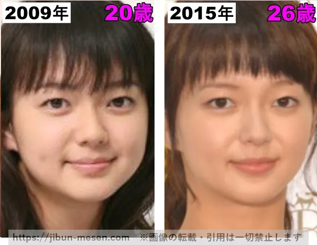多部未華子の唇の整形検証2009年〜2015年