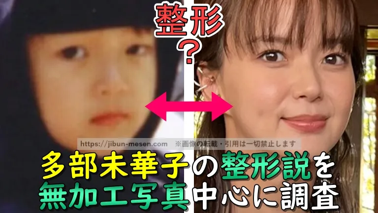 多部未華子の整形説を無加工写真中心に調査