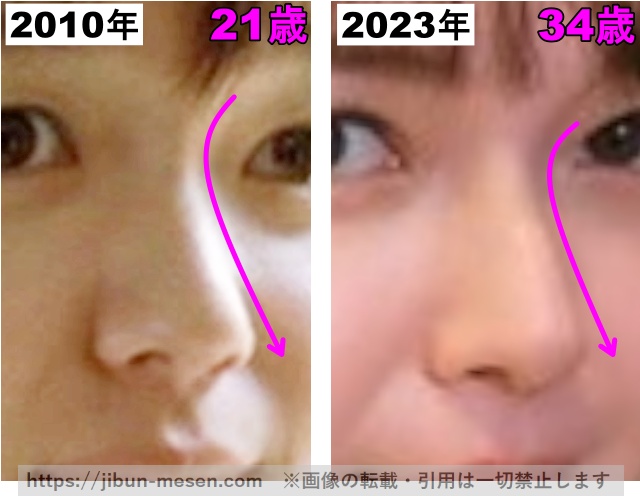 多部未華子の鼻の整形検証2010年〜2023年（拡大）の画像