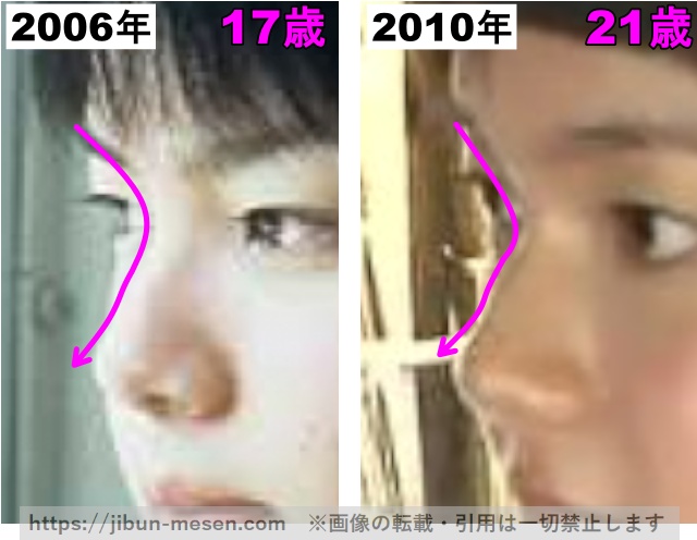 多部未華子の鼻の整形検証2006年〜2010年（拡大）の画像