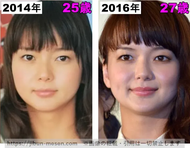 多部未華子の目の整形検証2014年〜2016年