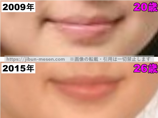 多部未華子の唇の整形検証2009年〜2015年（拡大）の画像