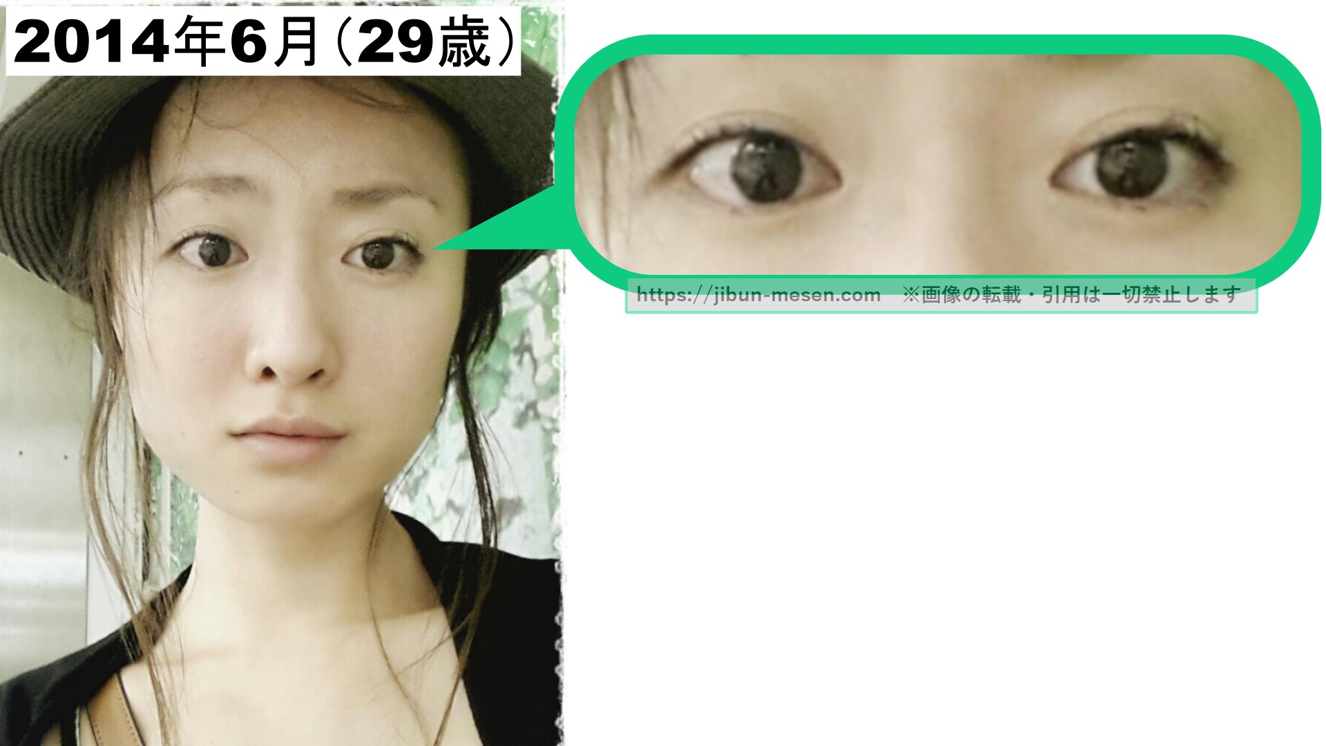 松本まりかの変化した二重幅の画像