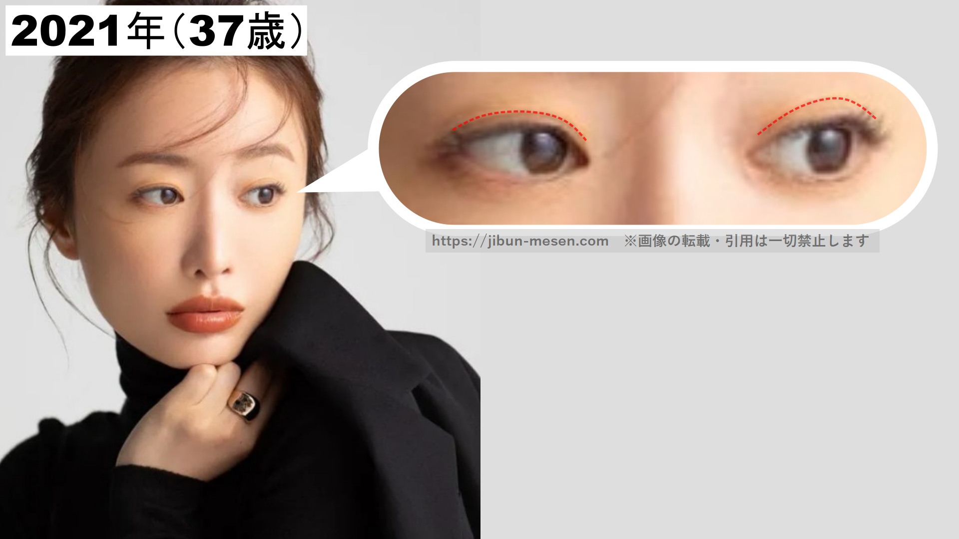 まぶたに左右差がある松本まりかの画像