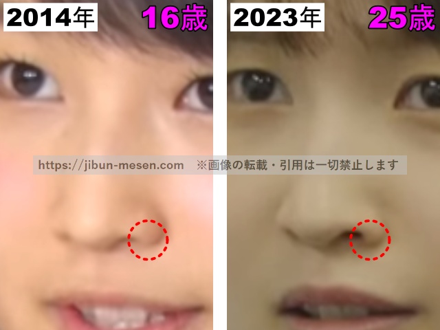 鞘師里保の小鼻の比較2014年〜2023年の画像
