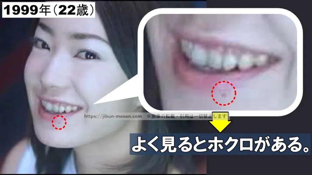 ホクロがある菅野美穂（1999年）