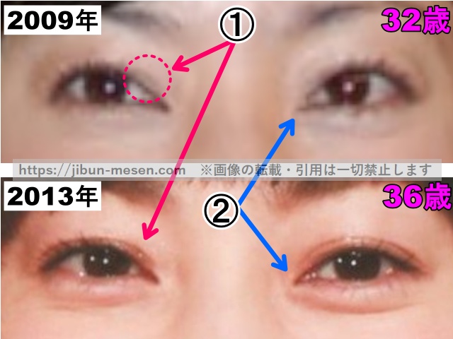 菅野美穂の目の整形検証2009年〜2013年（拡大）の画像