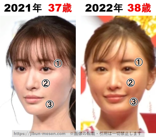 松本まりかの整形検証2021年～2022年の画像