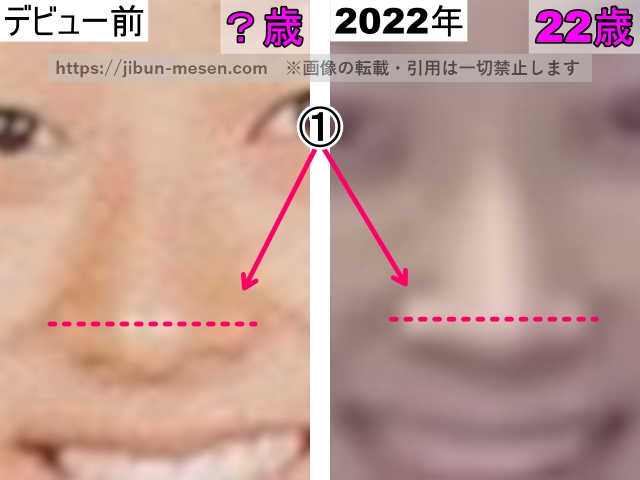ジゼルの鼻の整形検証デビュー前～2022年（拡大）の画像