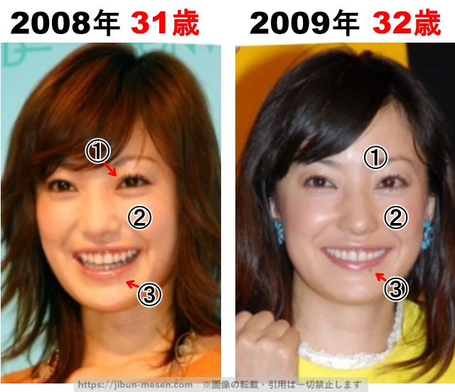 菅野美穂の整形検証2008年〜2009年の画像