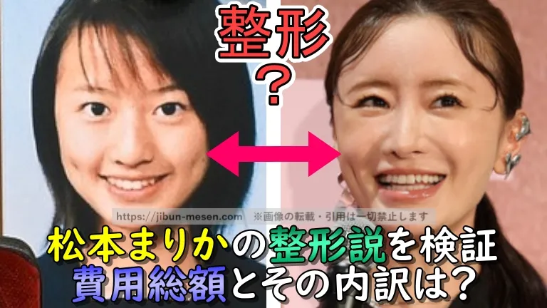 松本まりかの整形説を検証　費用総額とその内訳は？