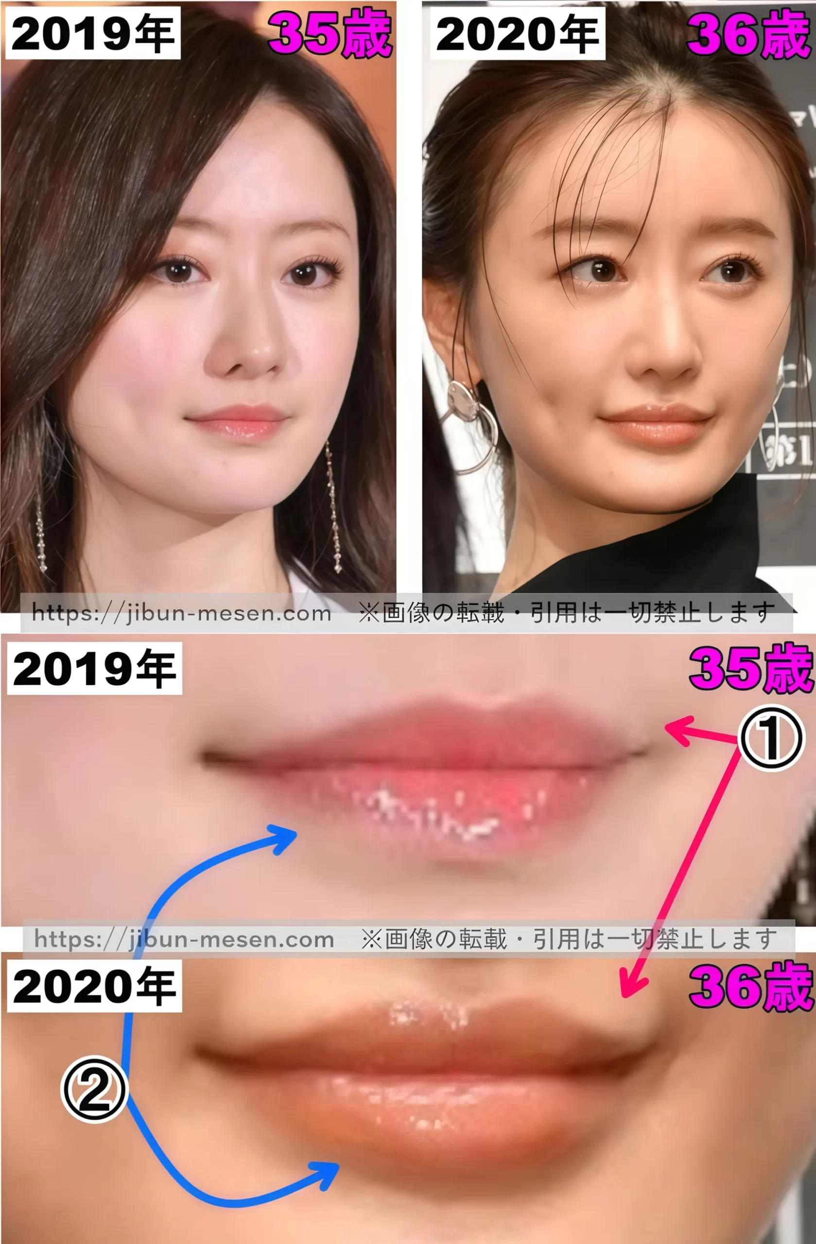 松本まりかの唇の整形検証2019年～2020年の画像