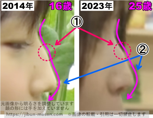 鞘師里保の鼻の整形検証2014年〜2023年（横顔・拡大）の画像