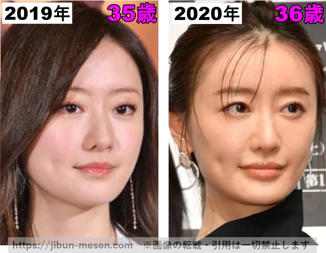 松本まりかの唇の整形検証2019年～2020年の画像