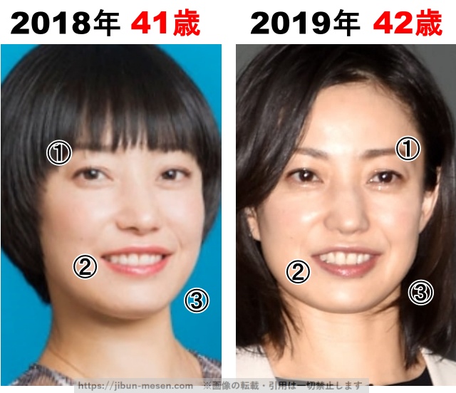 菅野美穂の整形検証2018年〜2019年の画像