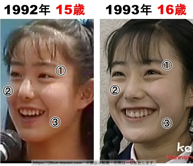 菅野美穂の整形検証1992年〜1993年