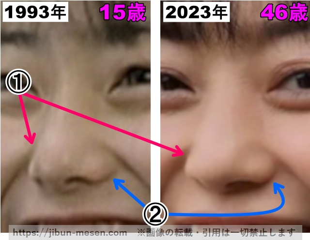 菅野美穂の鼻の整形検証1993年〜2023年（拡大）の画像