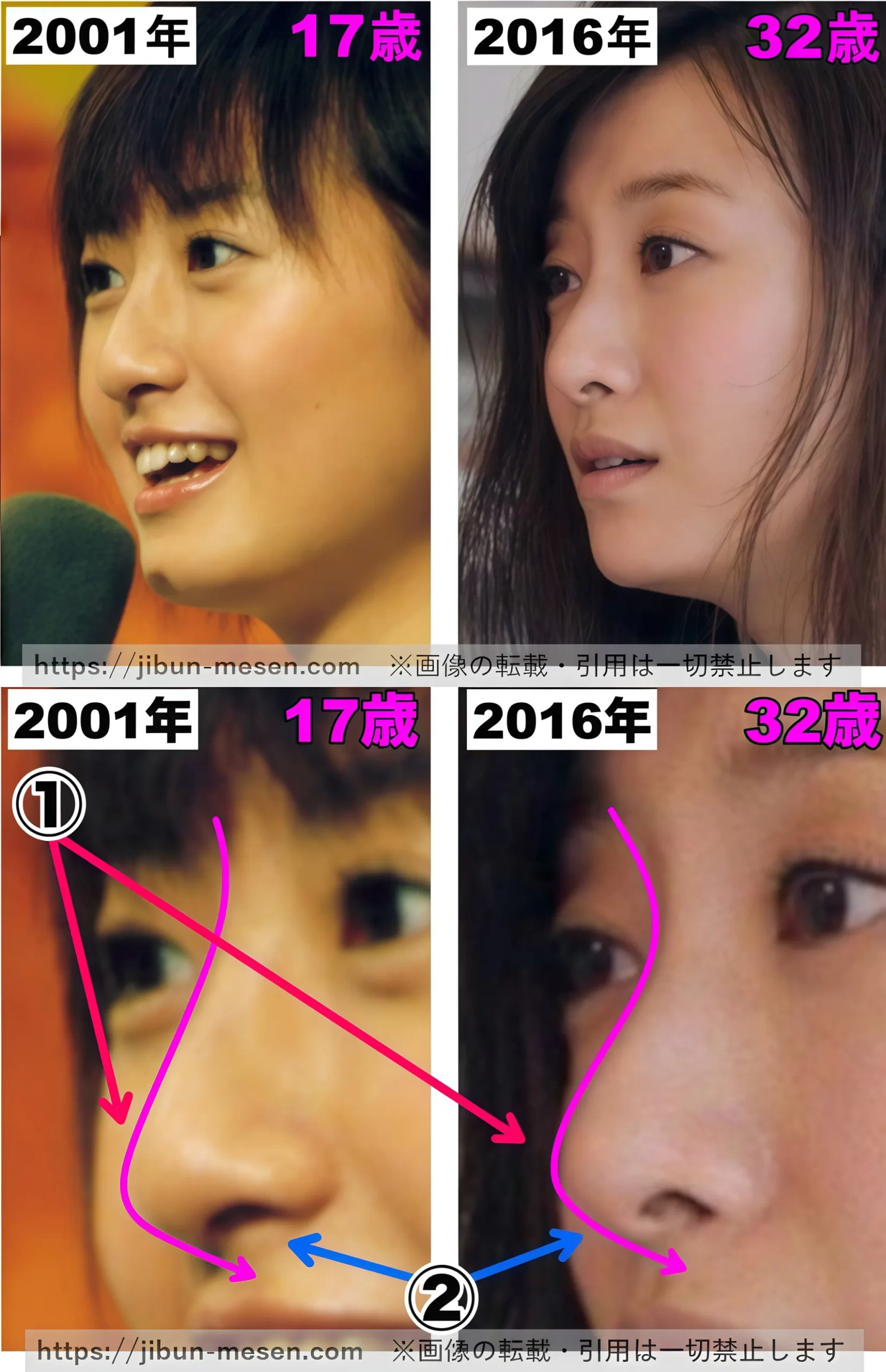 松本まりかの鼻の整形検証2001年～2016年の画像