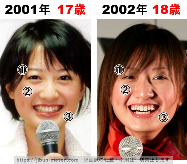 松本まりかの整形検証2001年～2002年の画像